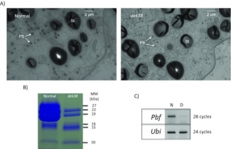 Transmission electron micrograph and RT PCR 