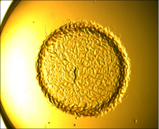 A sterile C. elegans hermaphrodite with a lawn of E. coli (worm food) to itself