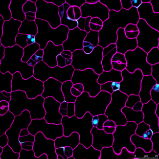 Polarized BASL protein (cyan) in stomatal lineage cells in Arabidopsis.